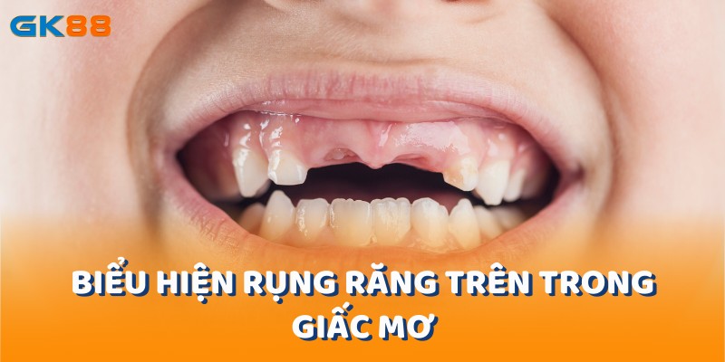 Biểu hiện rụng răng trên trong giấc mơ tại gk88